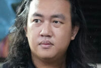 RSCM Jahit Kelopak Mata Andrie Yunus Selama Empat Bulan untuk Lindungi Bola Mata