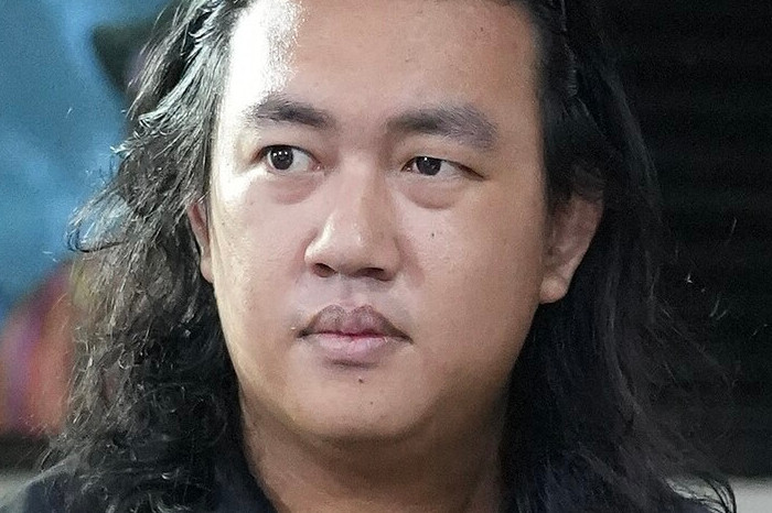 RSCM Jahit Kelopak Mata Andrie Yunus Selama Empat Bulan untuk Lindungi Bola Mata